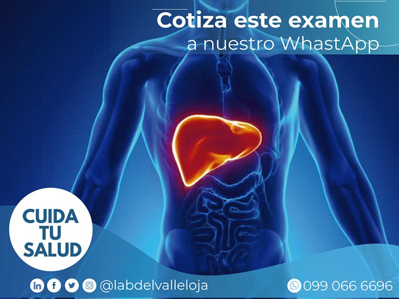 analisis Perfil Hepático